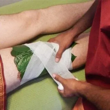 Bandhanam (Bandaging) Therapy